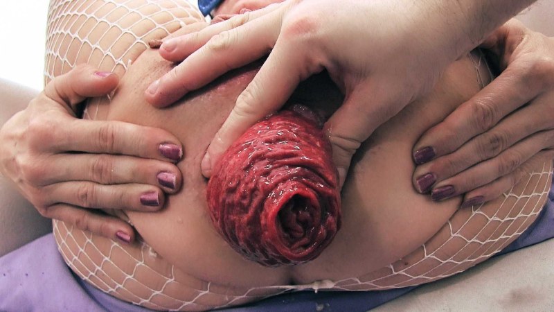 Anus turned inside out