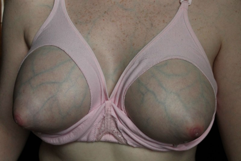Big elastic breasts with veins