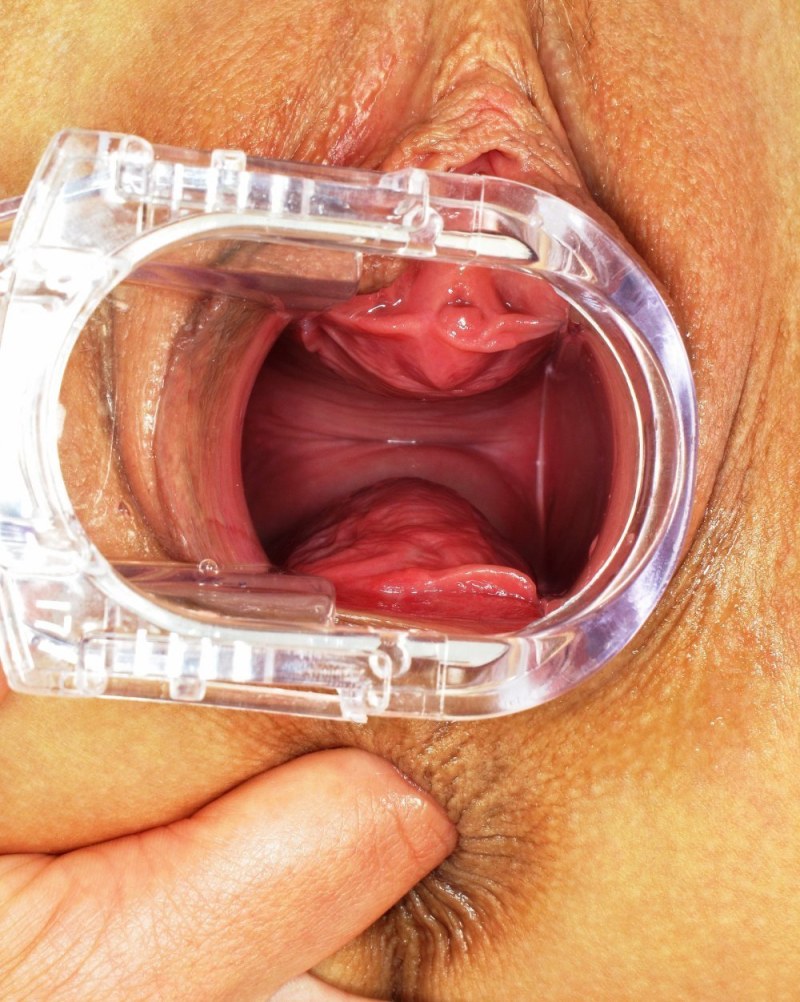 Healthy vagina from the inside