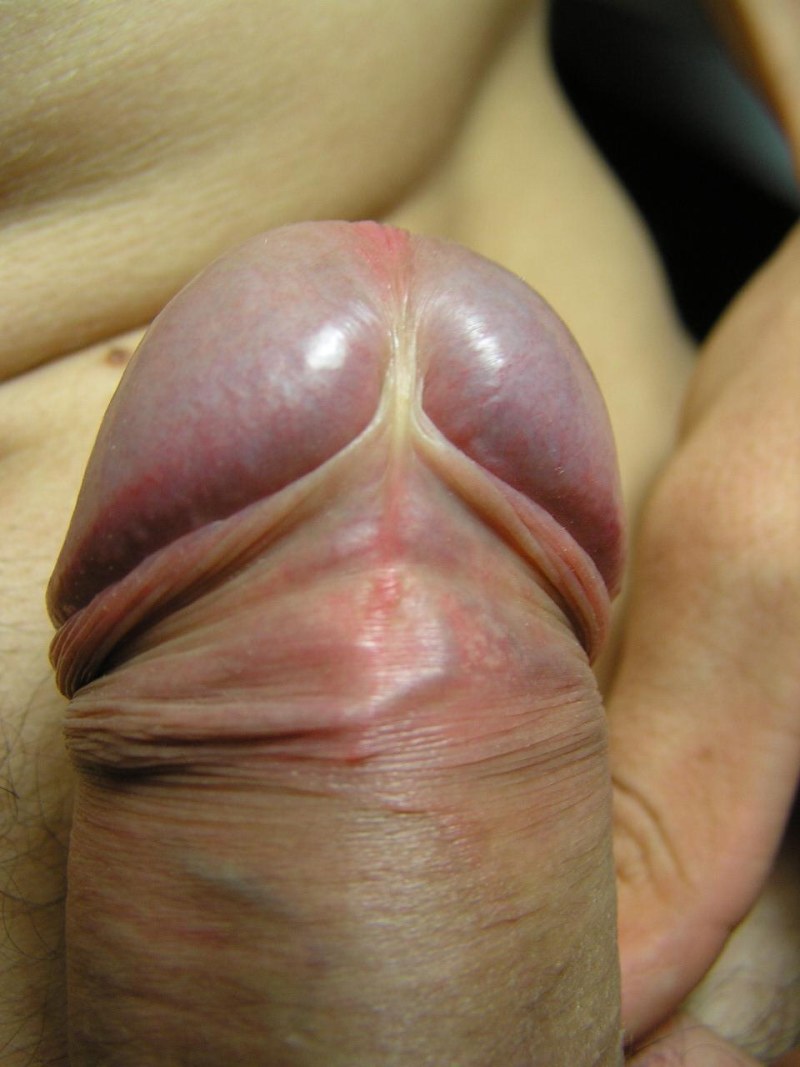 Vagina after a vacuum pump
