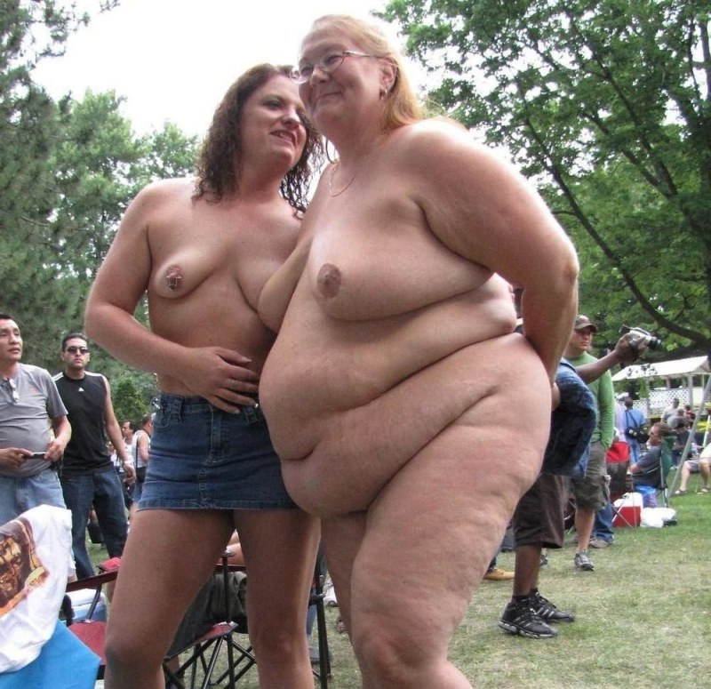 Polest -burned naked aunts