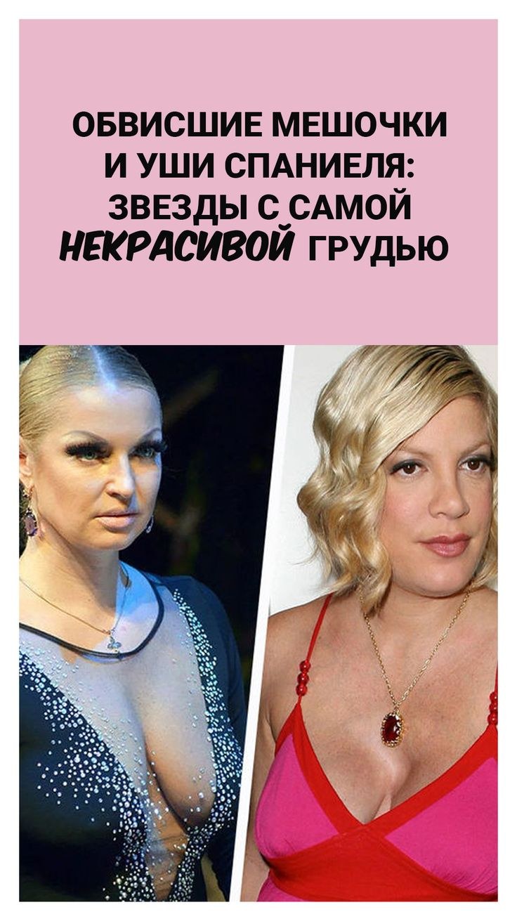 Female breast ears of spaniel