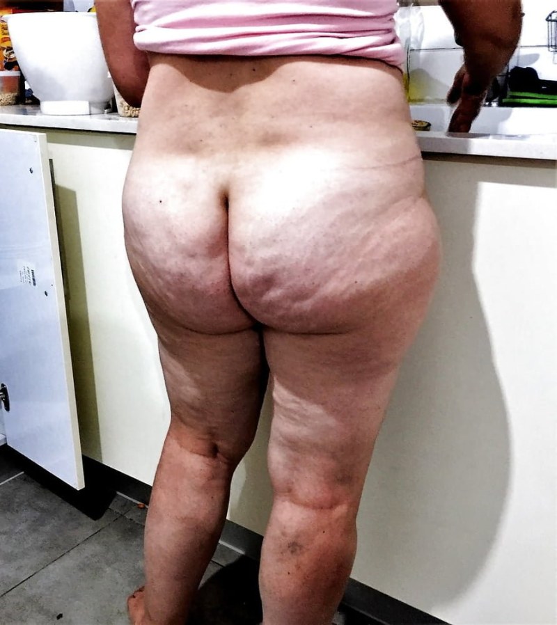 Naked elderly women with cellulite