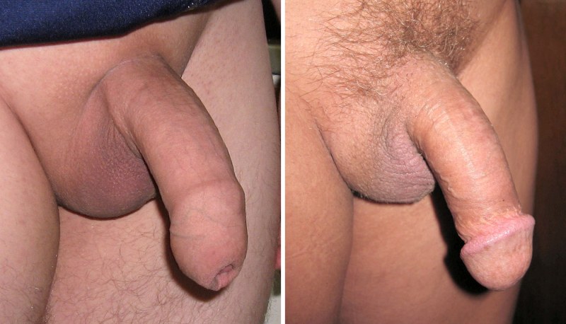 Male penis close -up