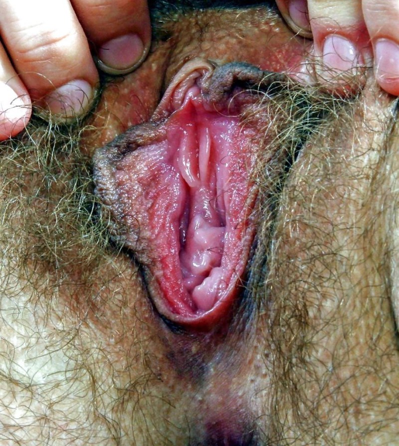 The worst female vagina