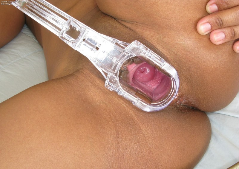 Large vaginal expander