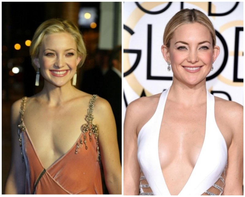 Sagging chest ears of spaniel