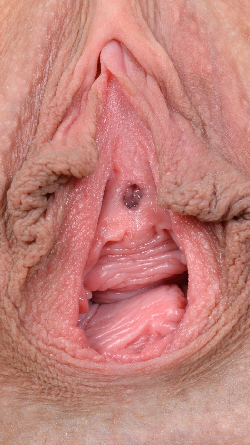 Old women with large labia