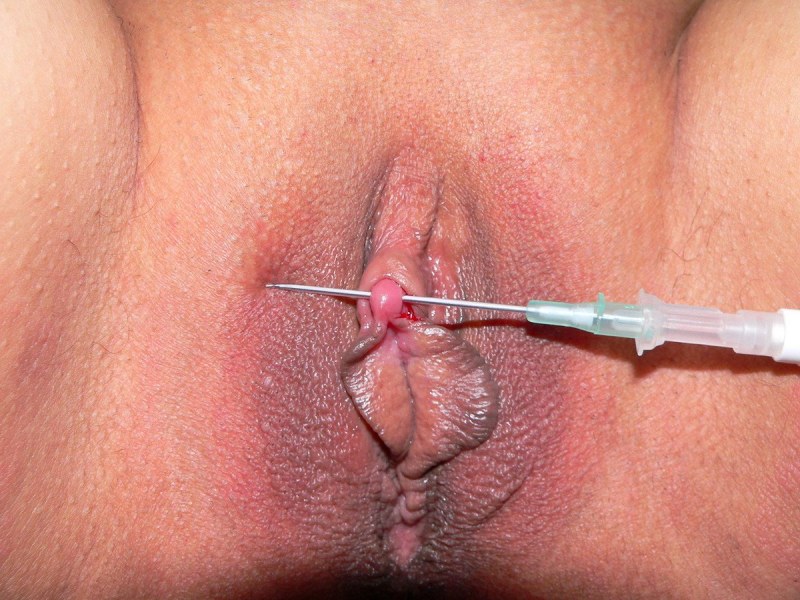 Vagina with clothespins