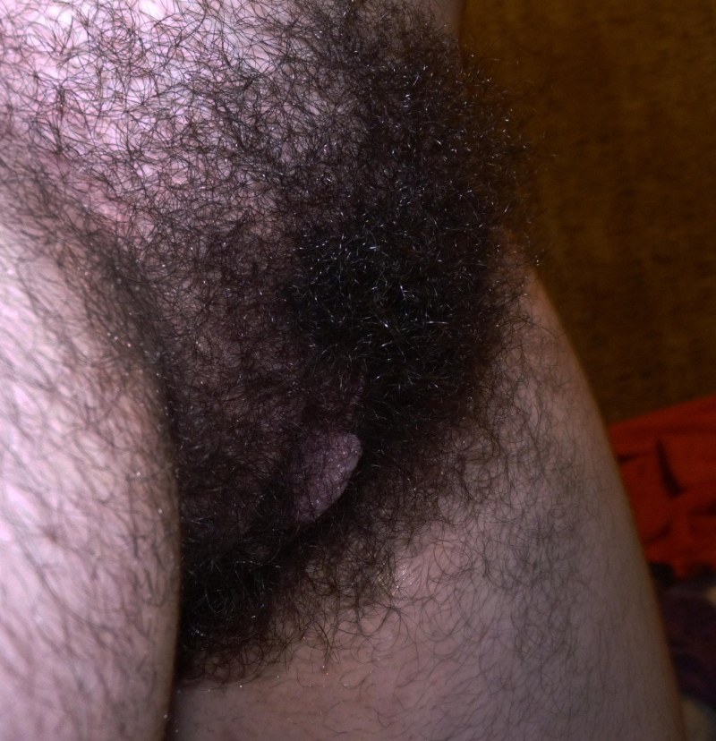 The most hairy female pubis