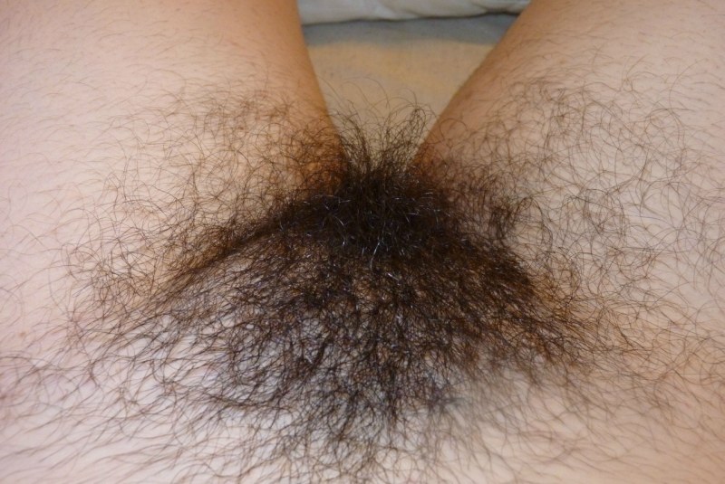 Very hairy female pubis