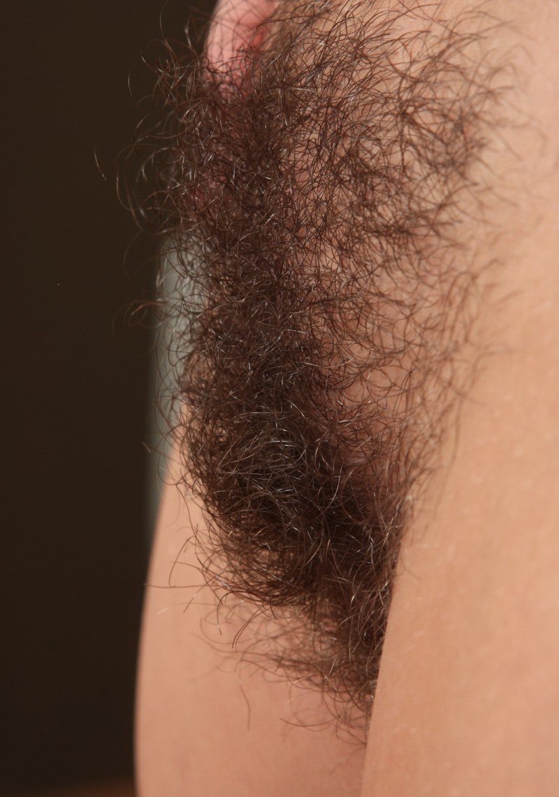 Very hairy female pubis