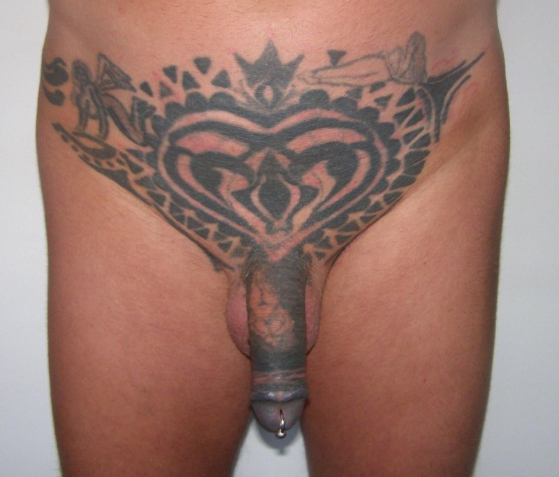Genital tattoos
