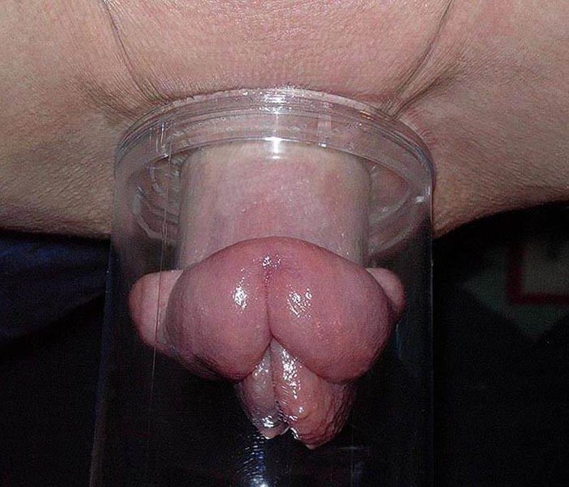 Clitoris after a vacuum pump