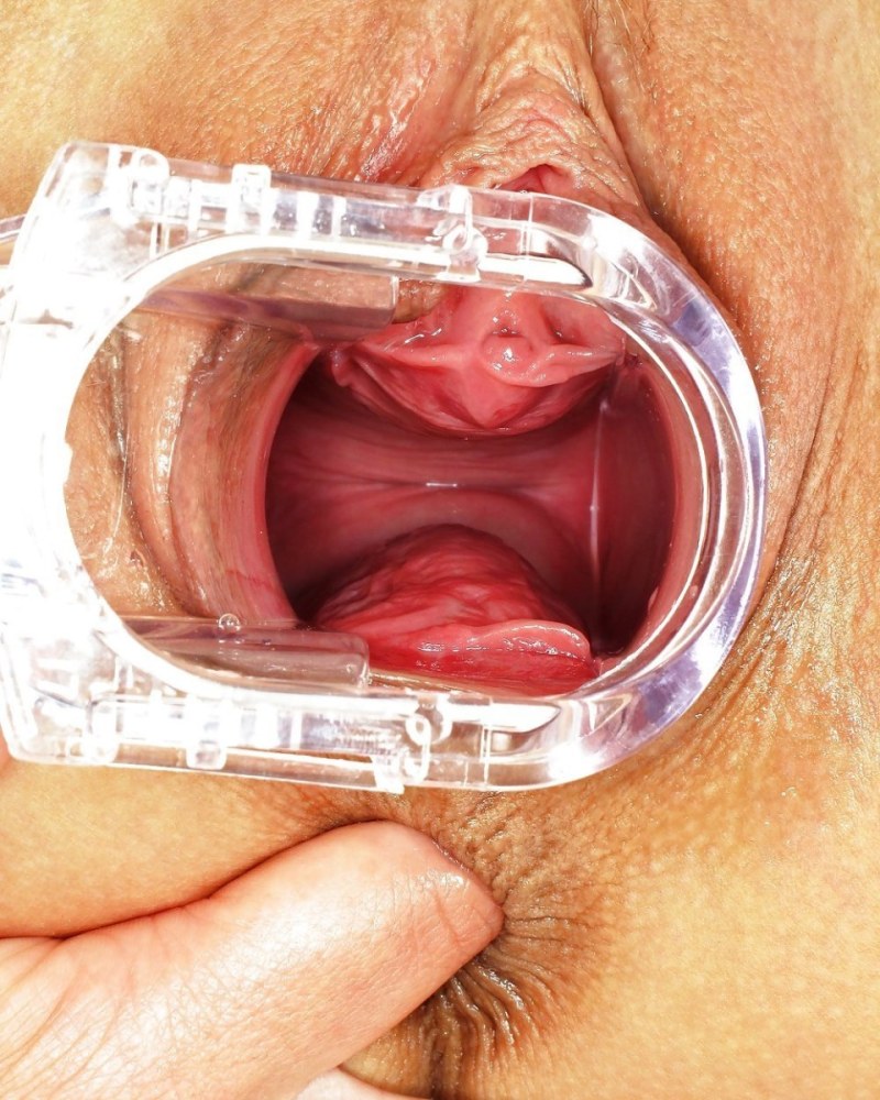 The camera inside the vagina