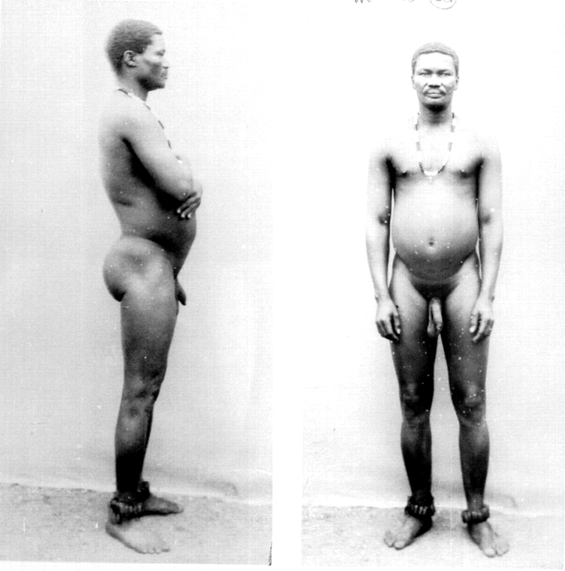 Unusual genital organs in women