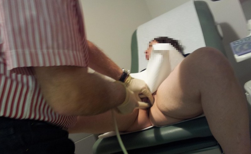 Hidden camera in female gynecology