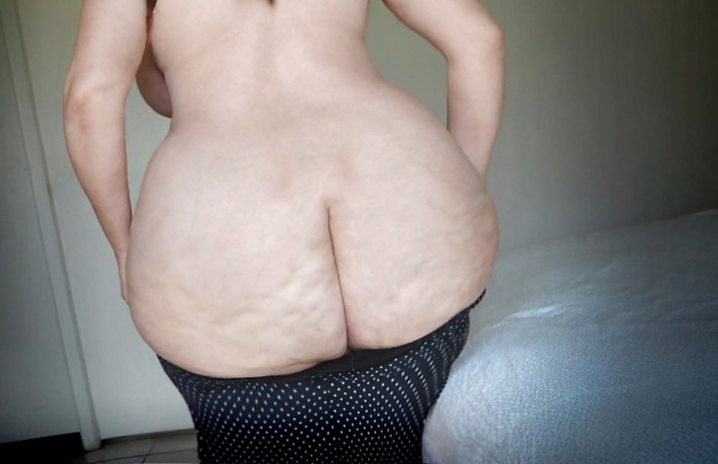 Drub cellulite asses