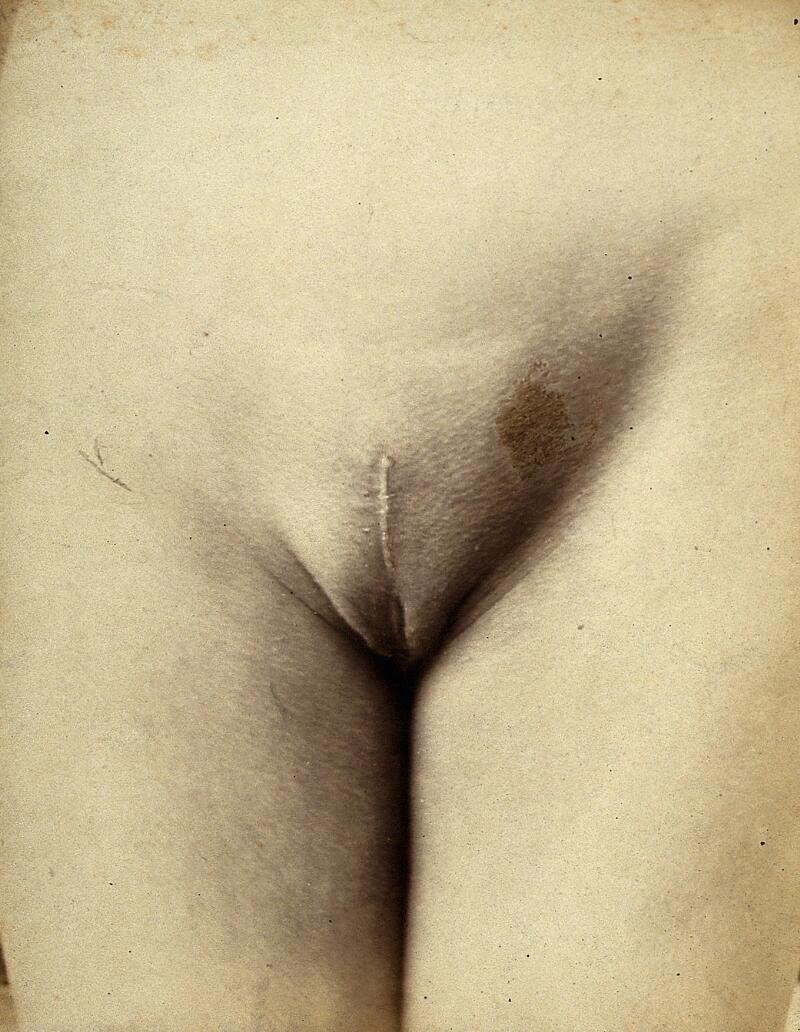 Feminine pubis in art