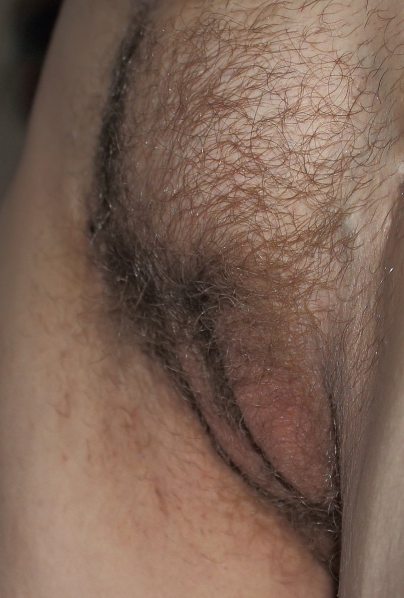 White pubic hairs