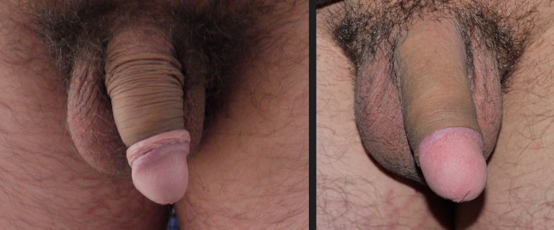 Male penis -cut dick