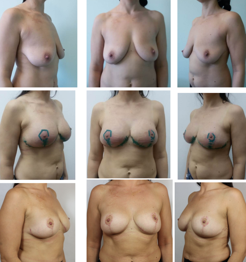 Women's boobs of different sizes