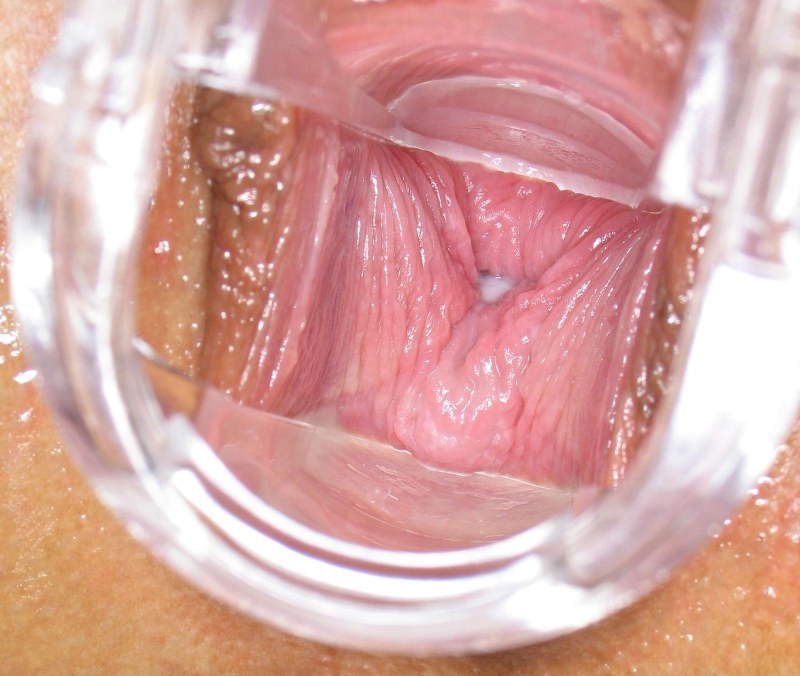 The insides of the vagina