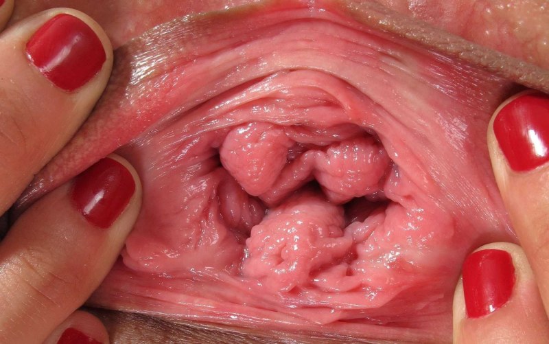 Women's vagina close -up