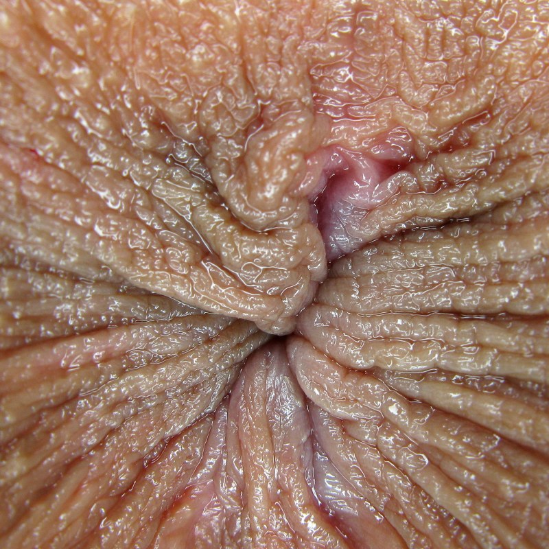 Thrush Women's Vagina