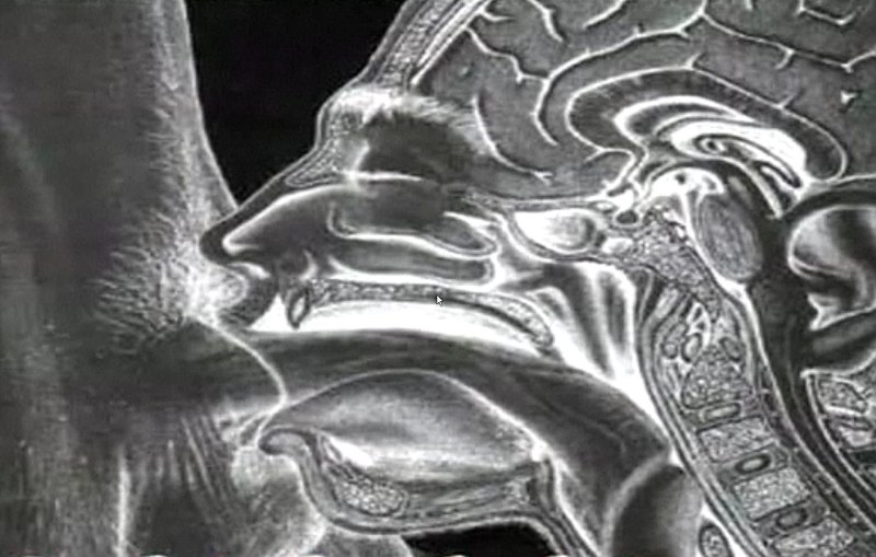 Huge female clitoris