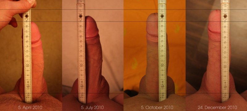 Measurement of the depth of the vagina