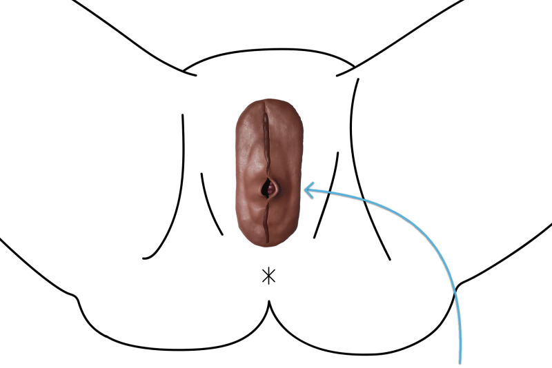 Changing vulva with age