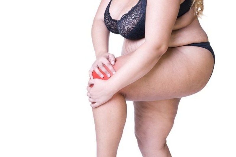 The cellulite priests of women aged