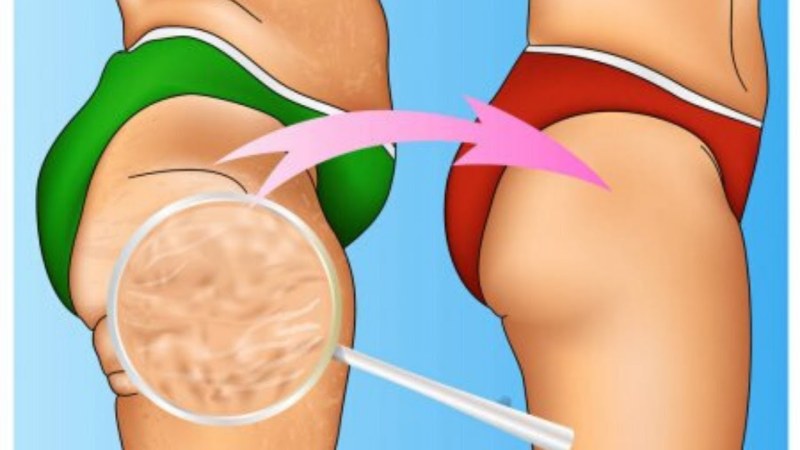 Exercises for removing Lyashki