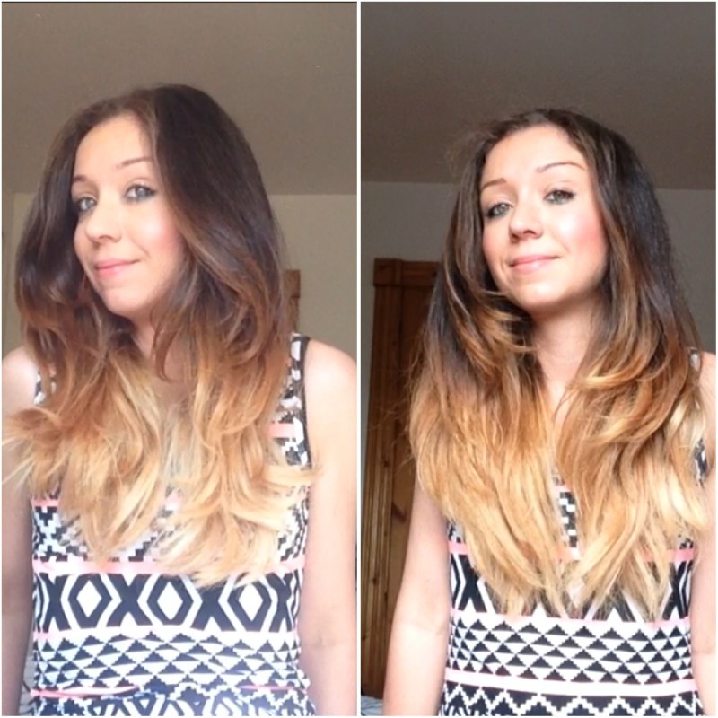 Botox basal hair volume