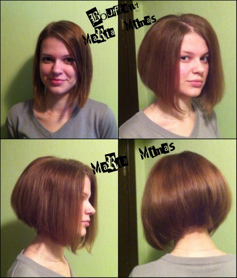 Botox basal hair volume