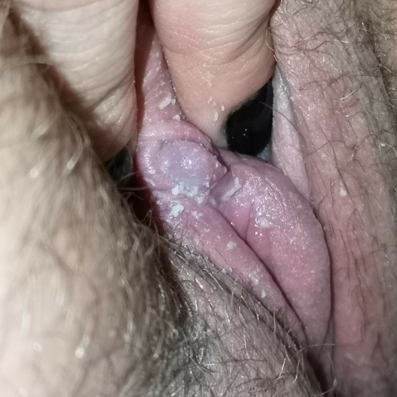 Dirty vagina with cottage cheese