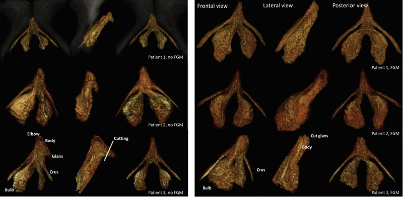 Inscriptions in intimate places