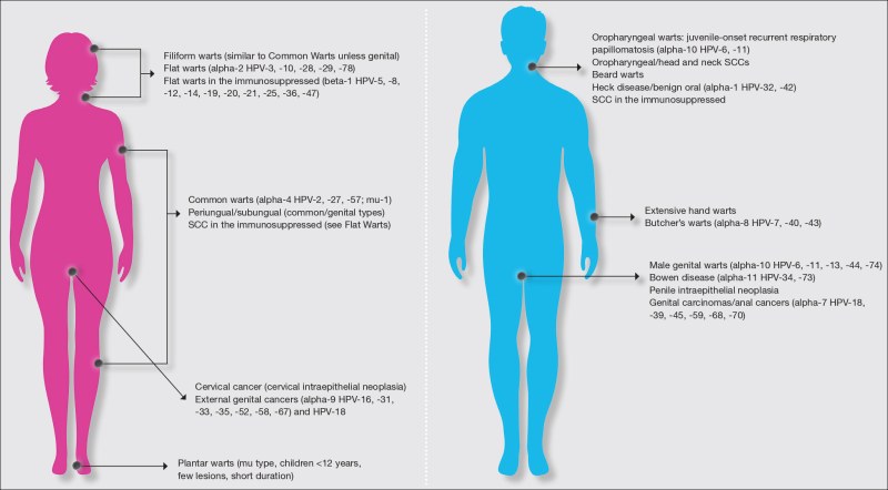 Girl is Taken Off Her Clothes and Get Naked