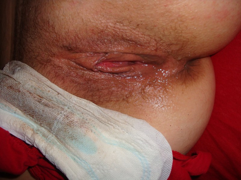 Dirty vagina in menstruation