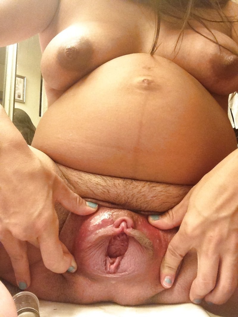 Vagina of a pregnant girl