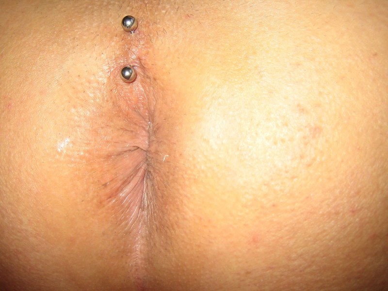 Women's anal piercing