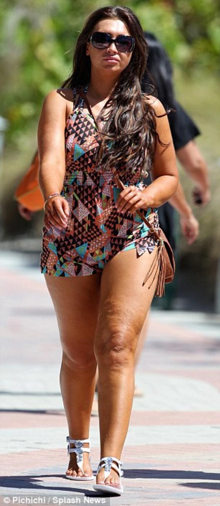 Thick Thight Cellulite