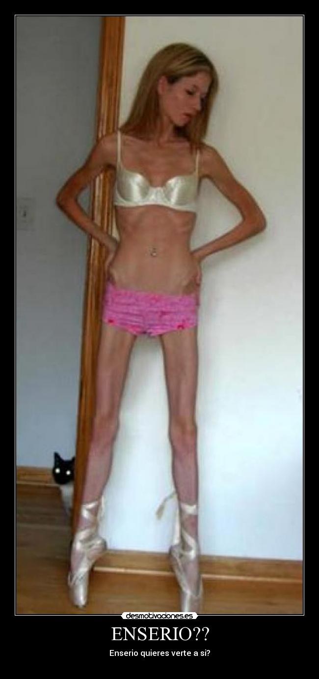 Naked anorexic girls