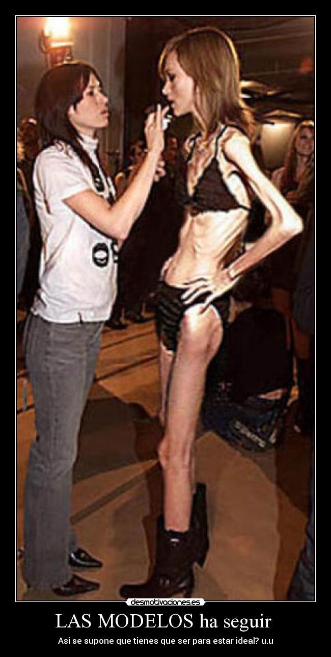 Very thin anorexics