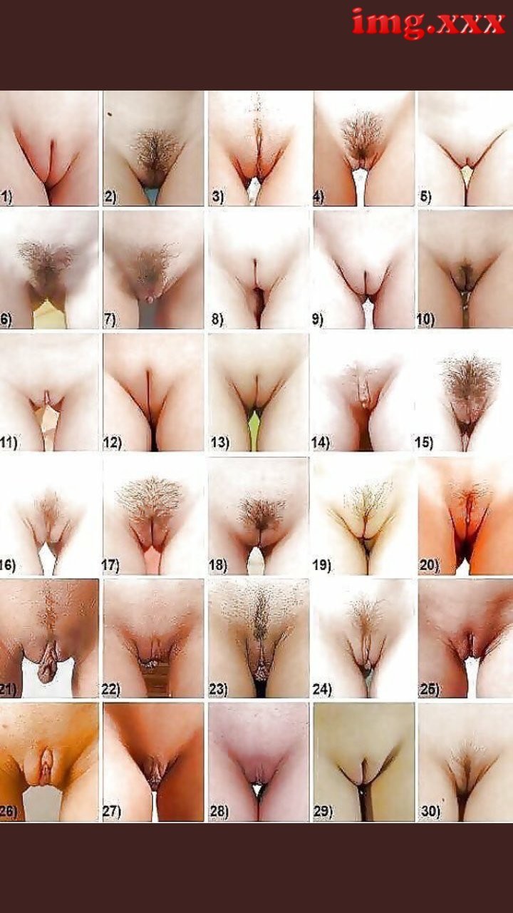 Varieties of women's vagina