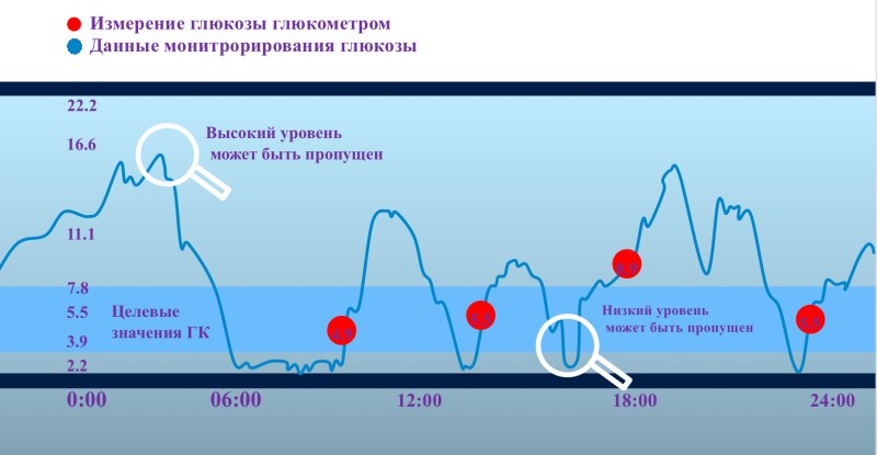 Continuing monitoring system of blood glucose