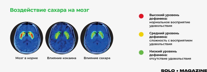 The effect of sugar on the human brain