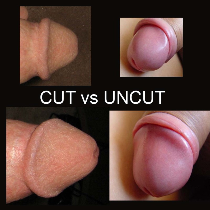 Forced Circumcision Rule34