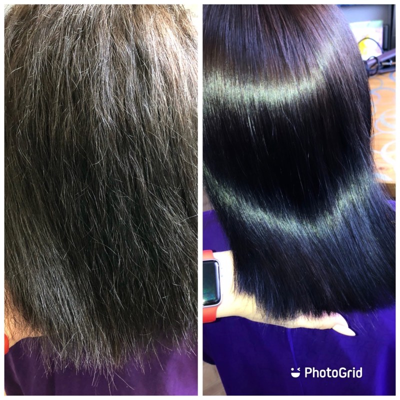 Elite selection is the only trilogy of KASS Kira